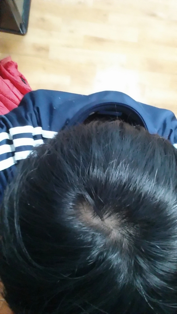 윗면.jpg
