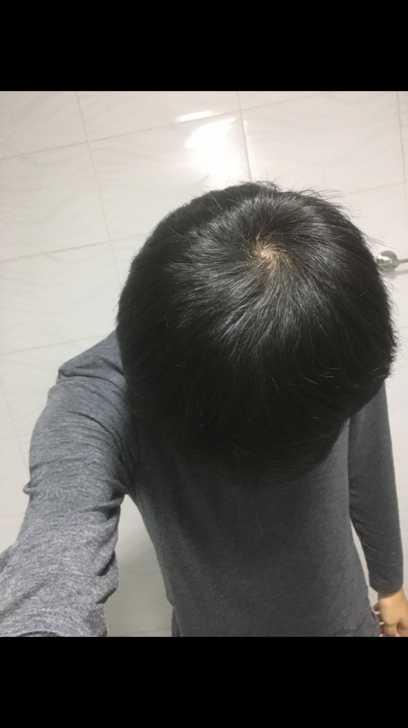 13F0BA4E-705E-4DE4-B58D-283F51A2FF84.png