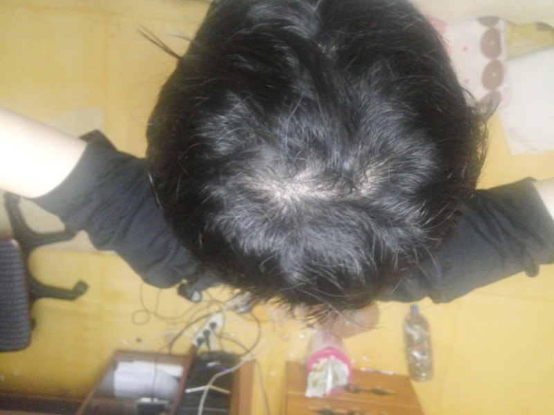 20161113_190337.jpg