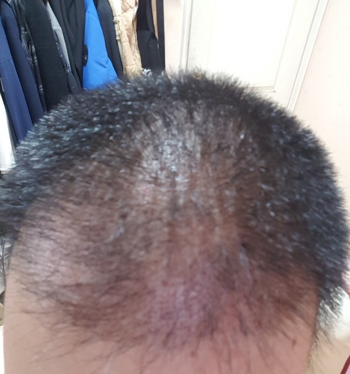 KakaoTalk_20180816_175625994.jpg