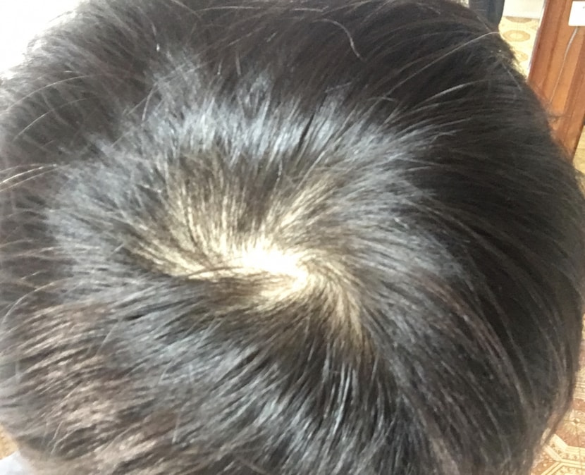 형광등 밑 정수리