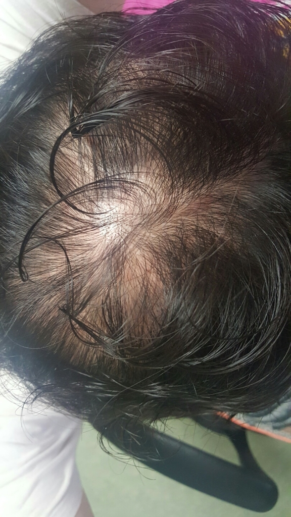 KakaoTalk_20170331_214922985.jpg