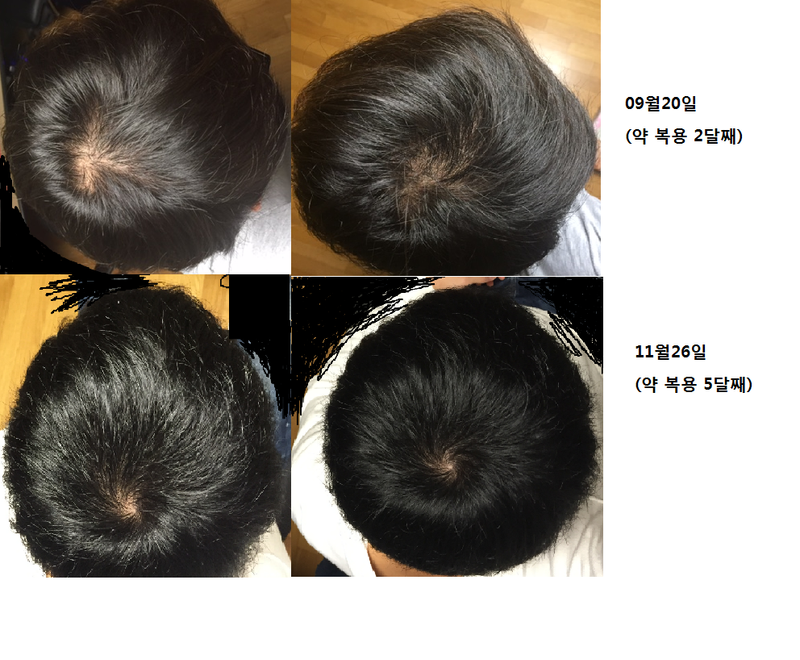 머리관리.png