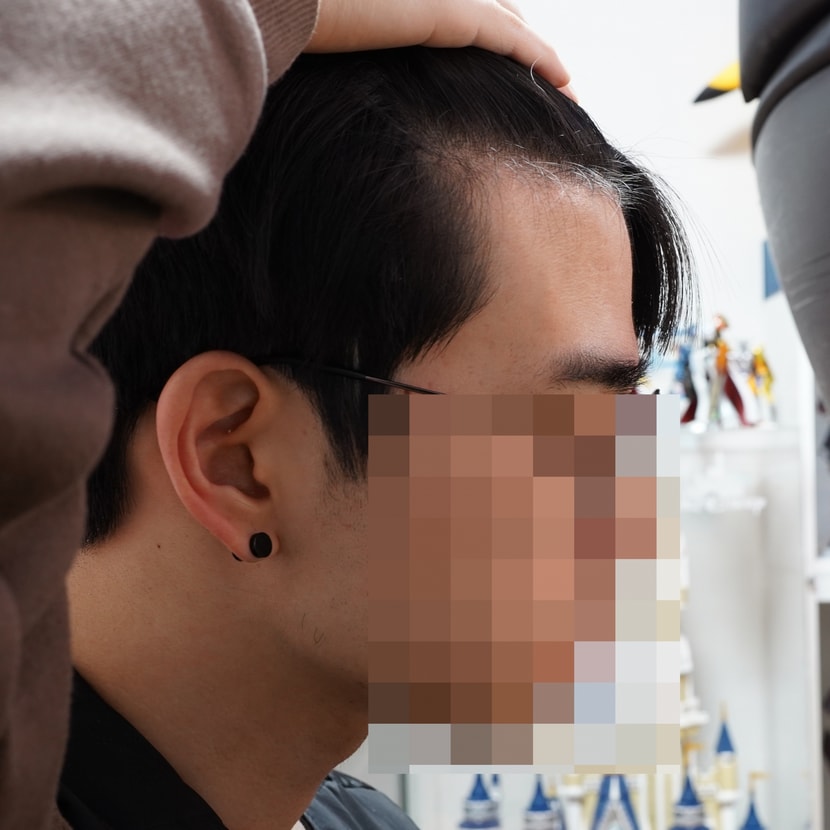 오른쪽