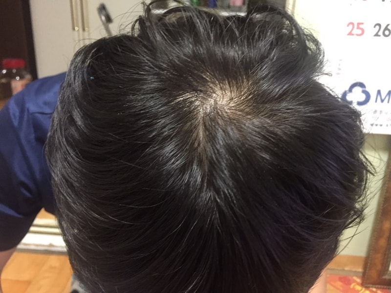 KakaoTalk_20170627_000735315.jpg