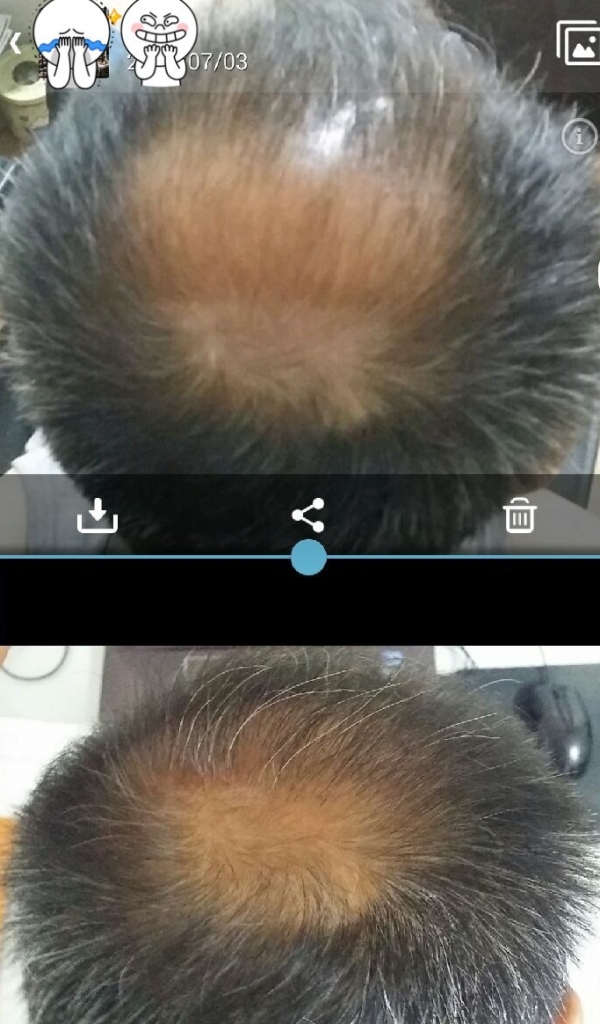 전후정수리.jpg