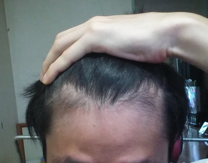 앞 머리.jpg