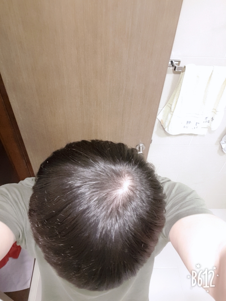 B612_20180406_184355.jpg