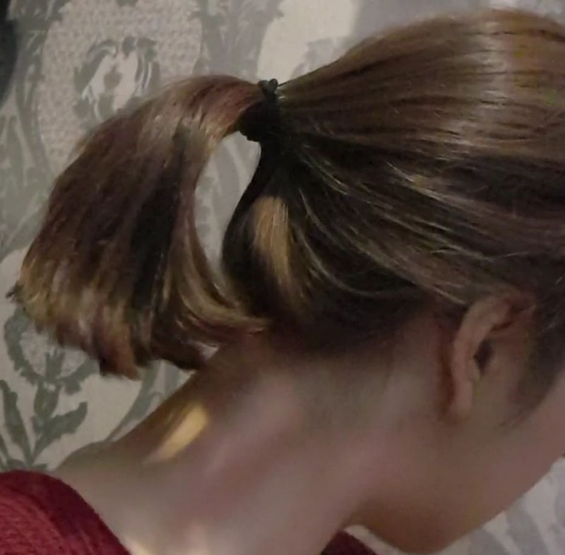 alopecia-20200217-113241-003.jpg