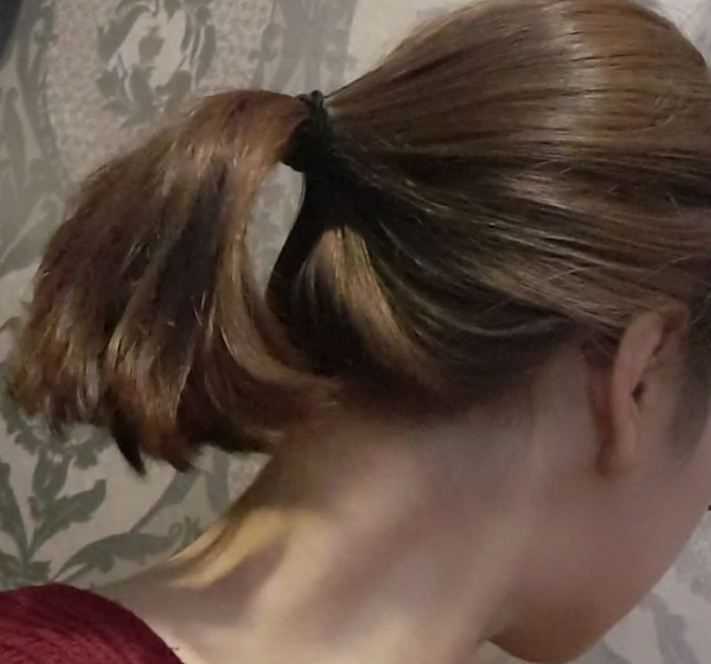 alopecia-20200217-113241-004.jpg