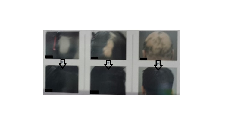 111111111111111.png