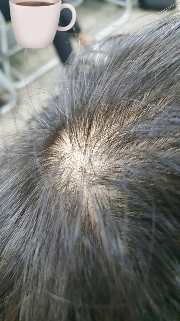 20181105_204725.jpg