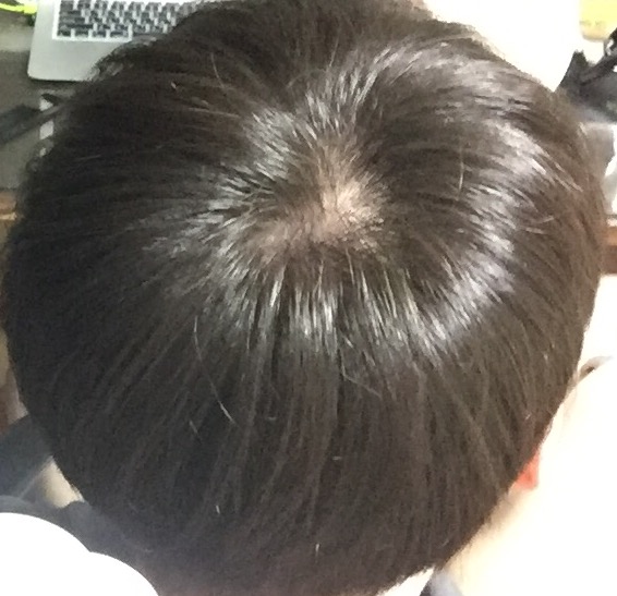 IMB_eVDS_358.JPG