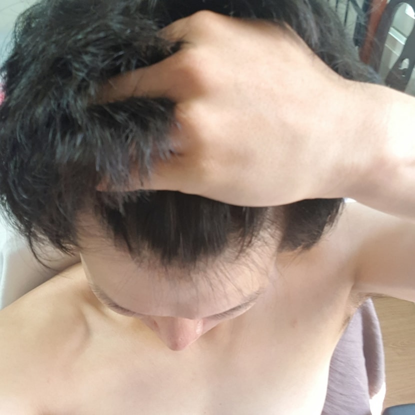 윗면