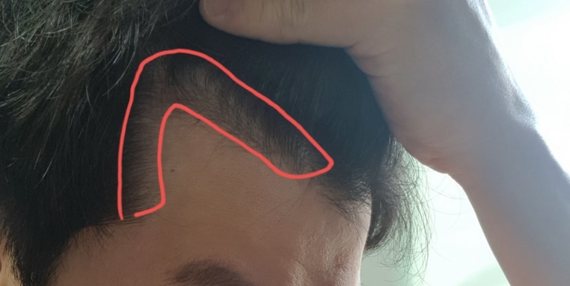 히긋히긋하면 안좋은 징조인가요~:? 