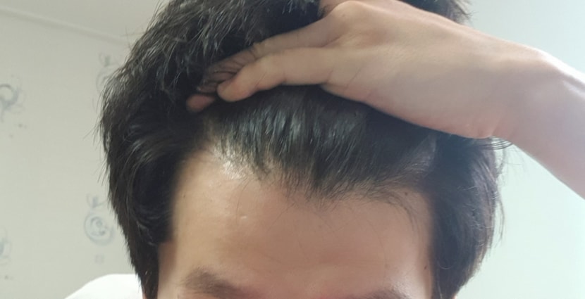 정면