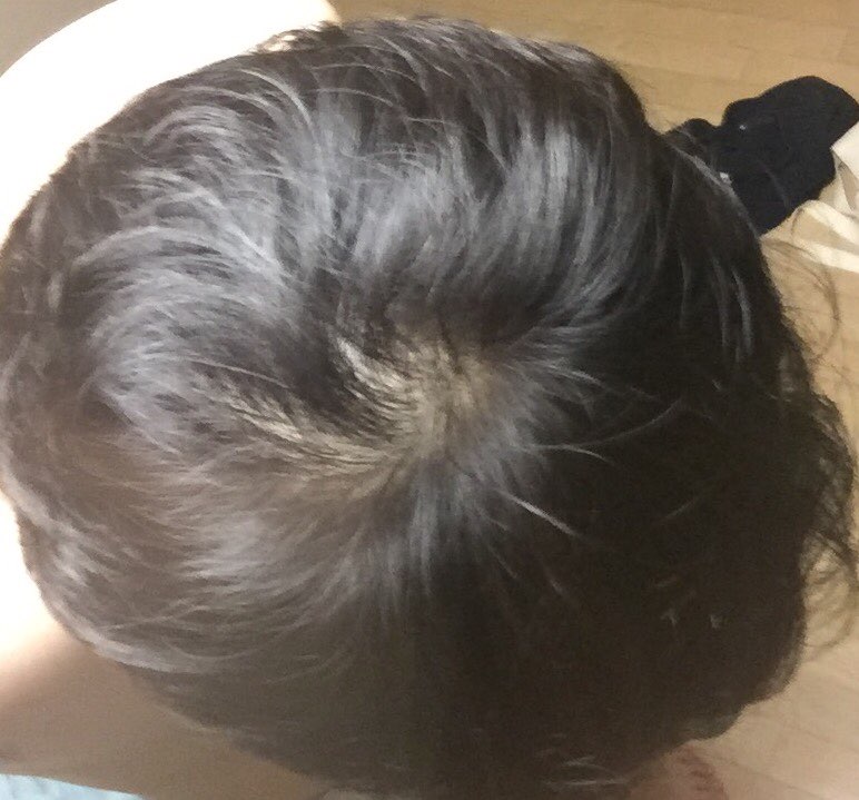 KakaoTalk_20160703_202042802.jpg
