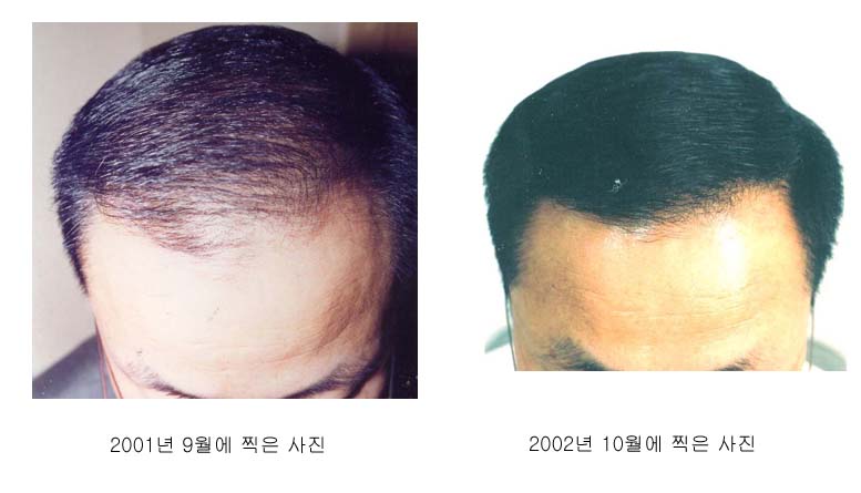머리바라.jpg