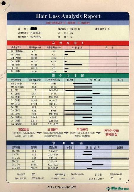 모발미네.jpg