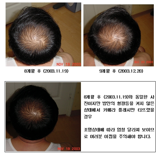비교사진(9개월후)_2.jpg
