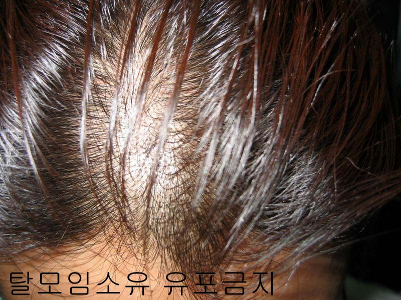 앞머리2_.jpg