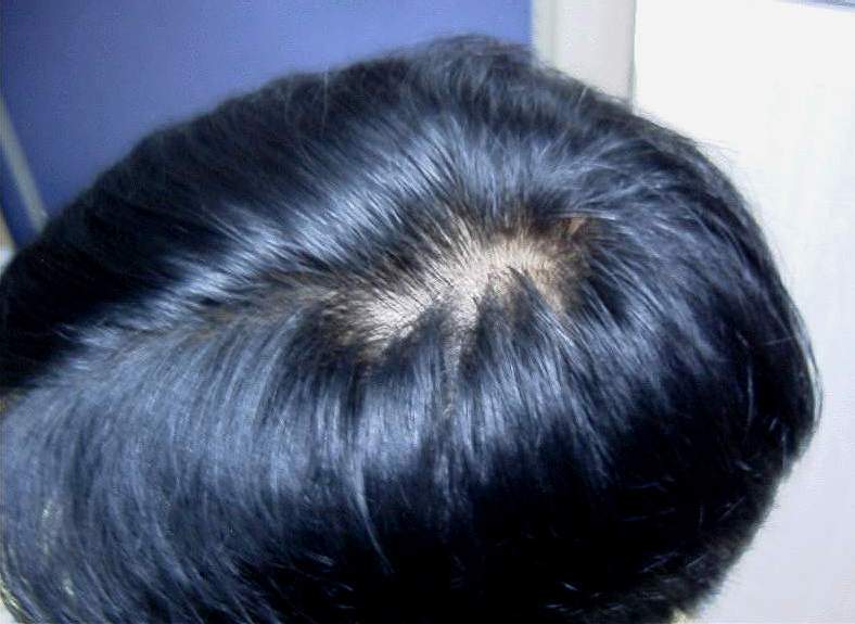 정수리.JPG
