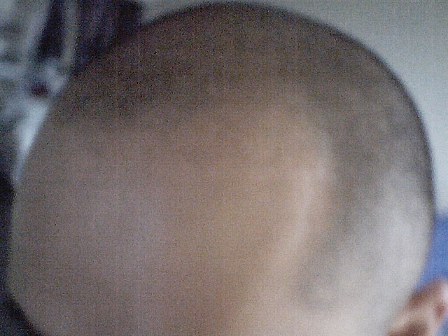 baldy.jpg
