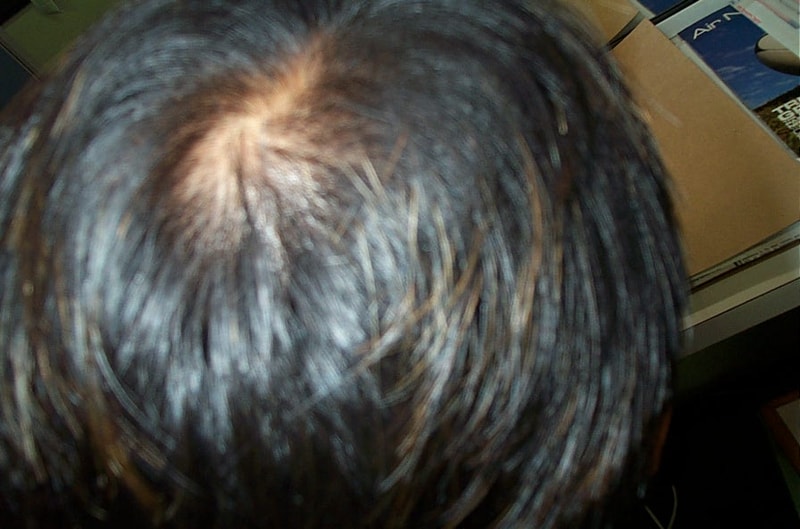 정수리3.JPG
