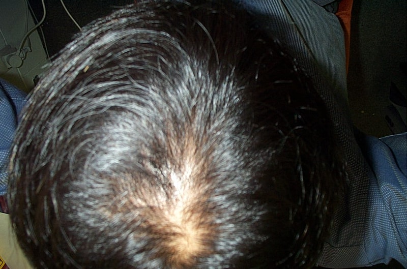 정수리1.JPG