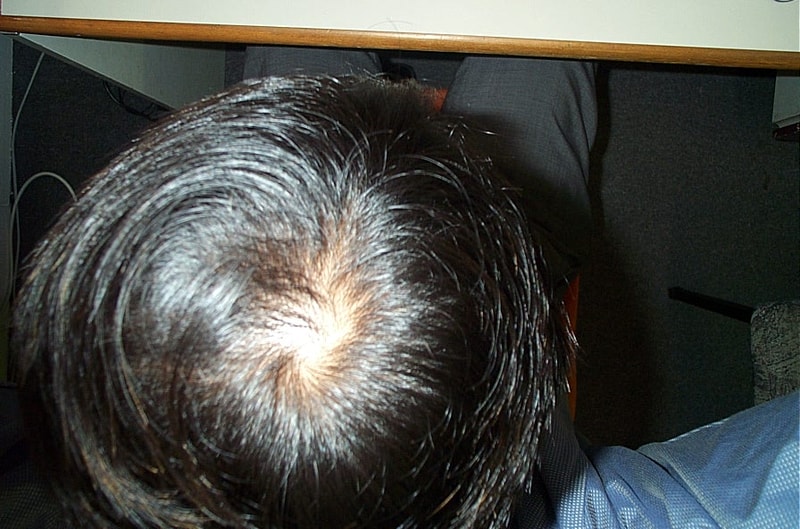 정수리2.JPG