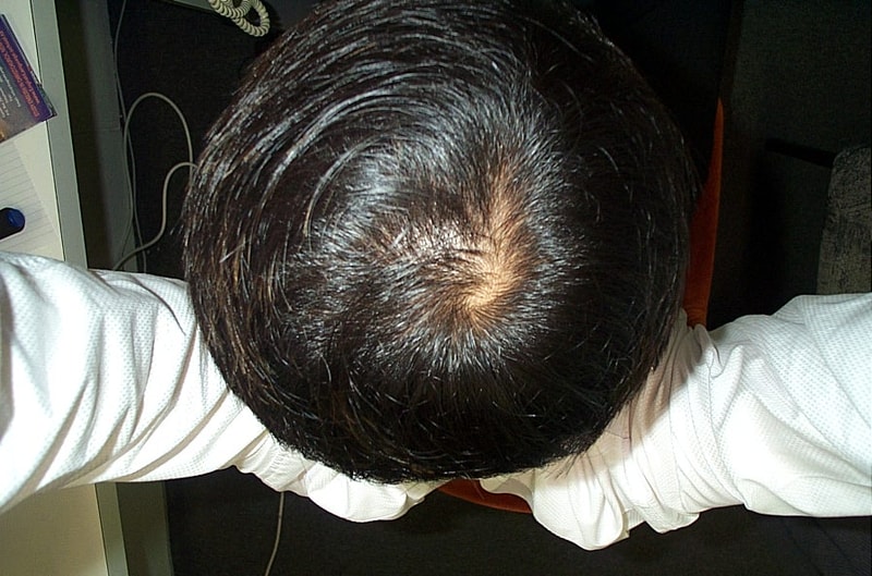 정수리1.JPG