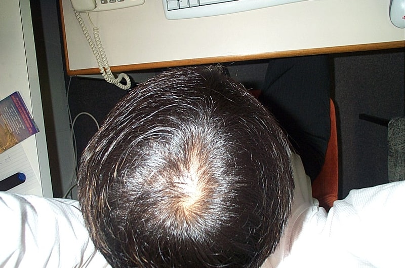 정수리2.JPG