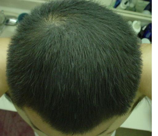 After.JPG