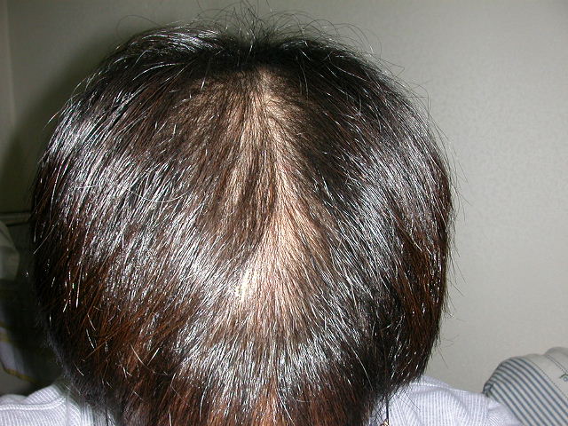 Dscn1790.jpg