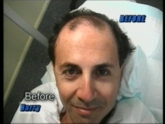 Harry_Before_fullface.jpg
