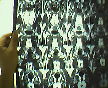 mri1.bmp