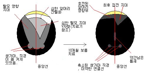 pic1_kor.jpg