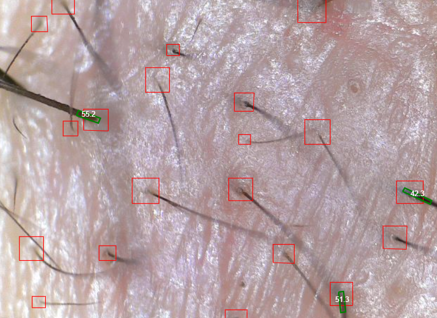 치료전 (2).png