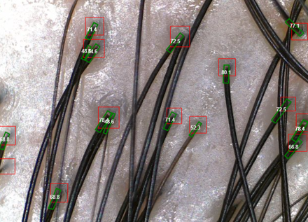치료후 (2).png