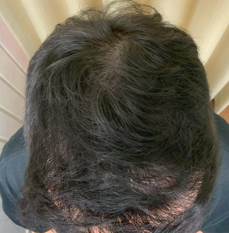 김형민85 관리후.png