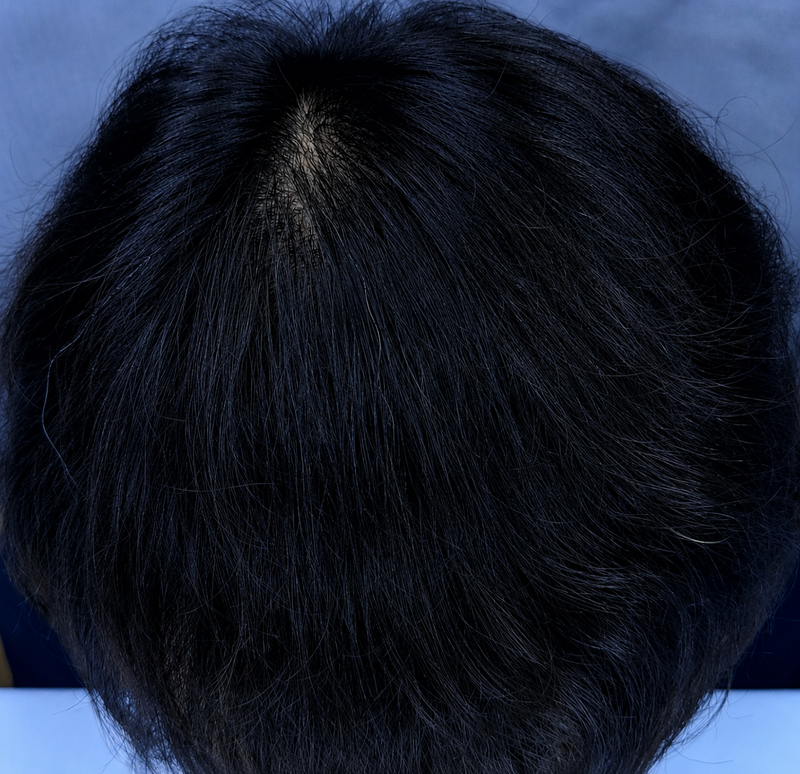 김용휘98 mts20회 후2.png