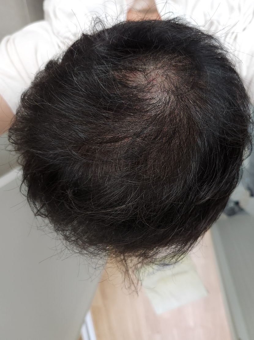 치료시작때 찍은 사진입니다
