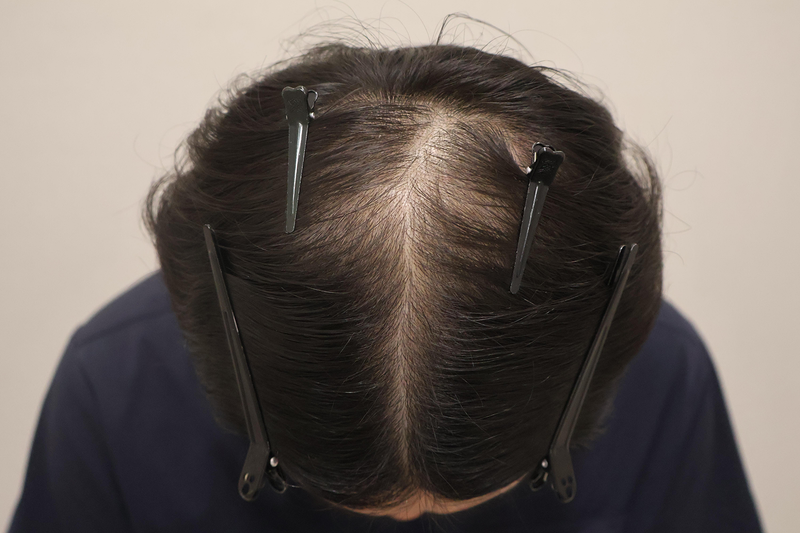 4.png