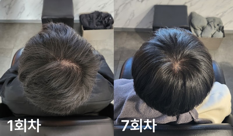 유현수님_관리경과 1.jpg