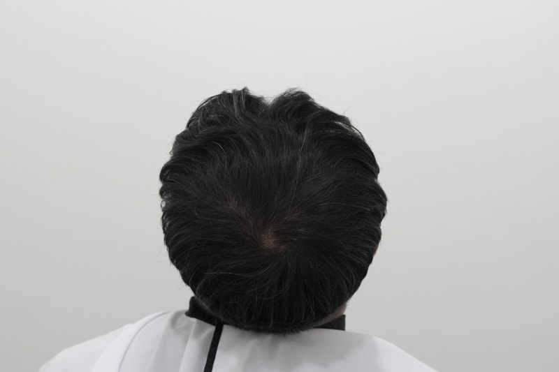 후2.jpg