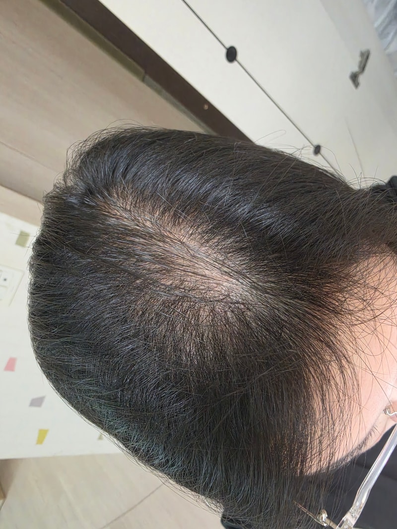동탄 ㅎㅇㄹ 에서 치료시작해요