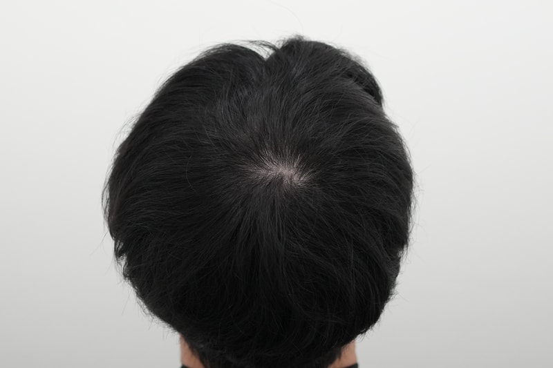 치료후.jpg