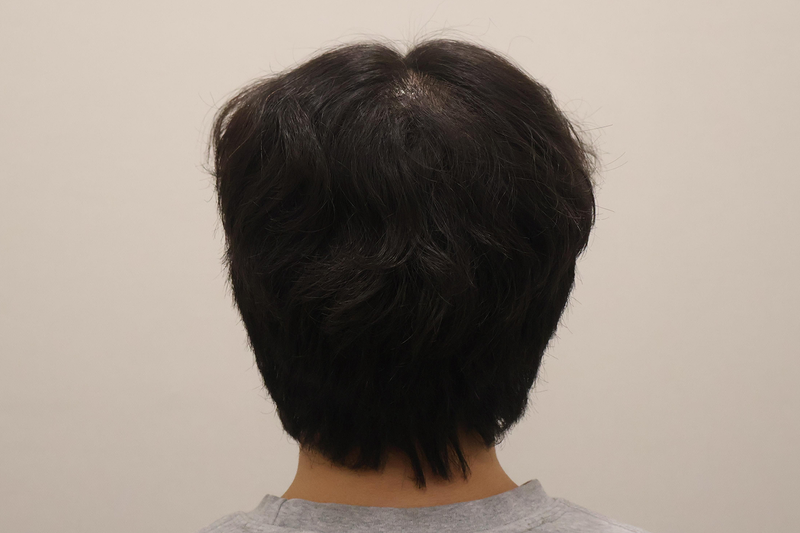 수원 탈모치료 찾다가 동탄까지 가길 잘한듯