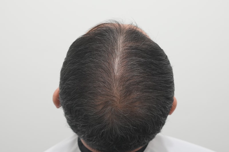 치료전.jpg