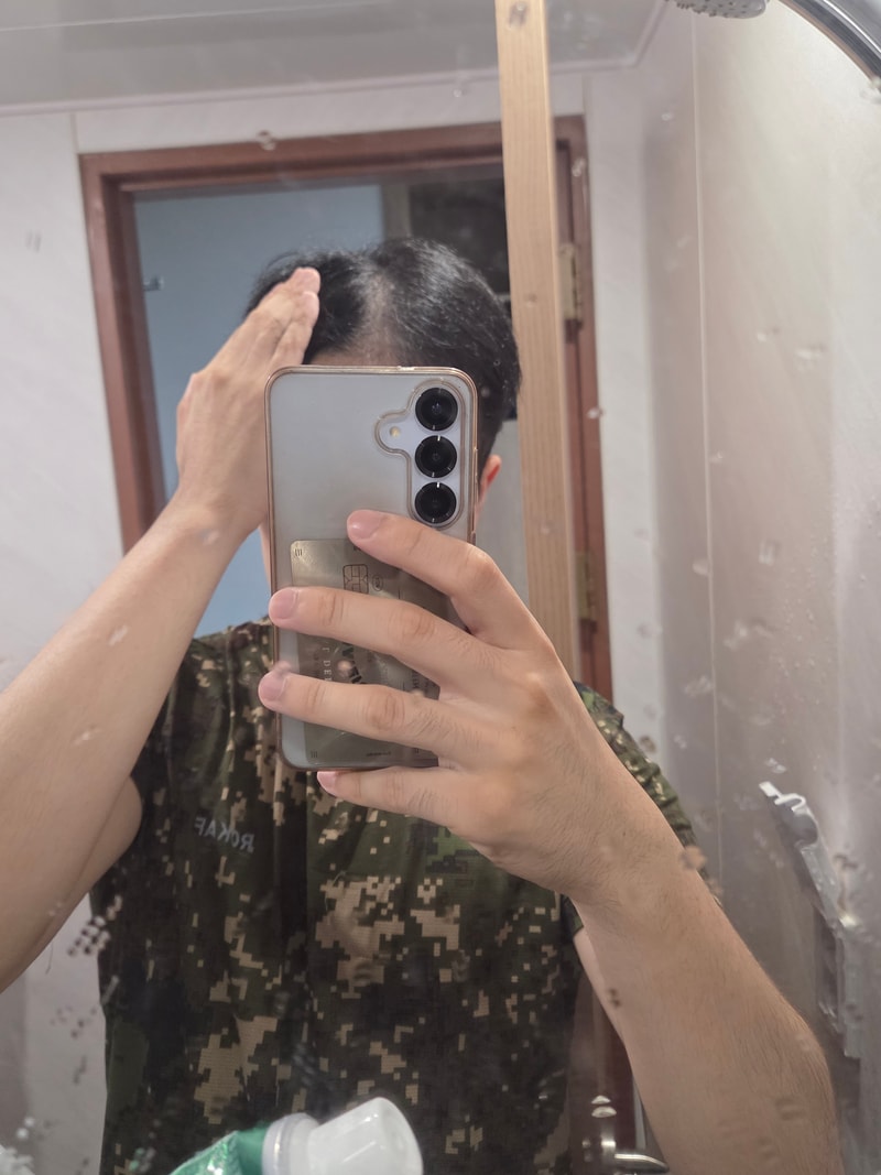 ㅎㅇㄹ 동탄 탈모치료 3회차 후기
